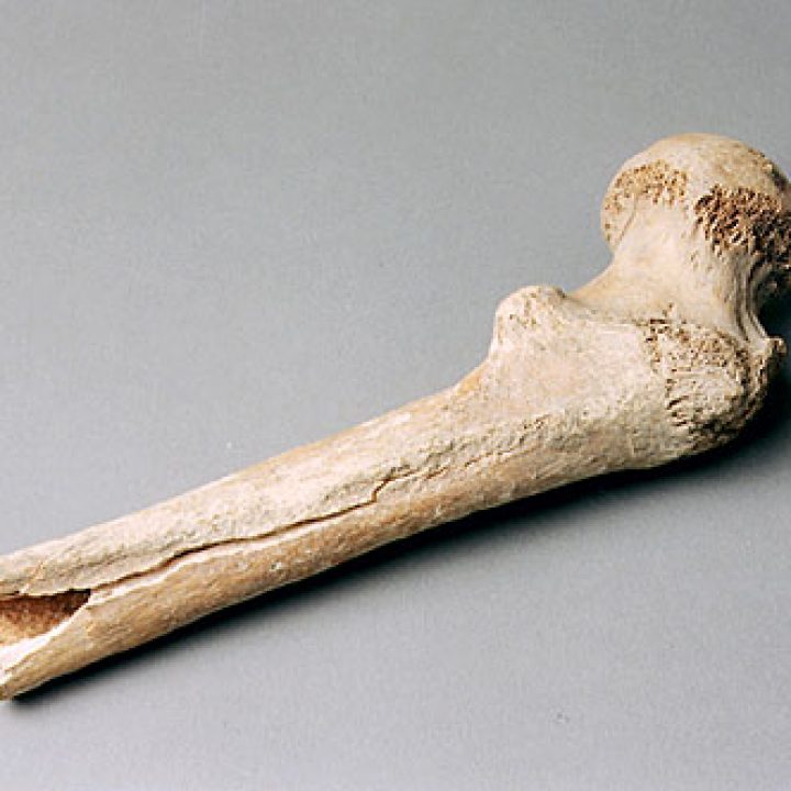Část pravé stehenní kosti